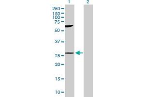 Western Blot analysis of LIN7A expression in transfected 293T cell line by LIN7A MaxPab polyclonal antibody. (LIN7A antibody  (AA 1-233))