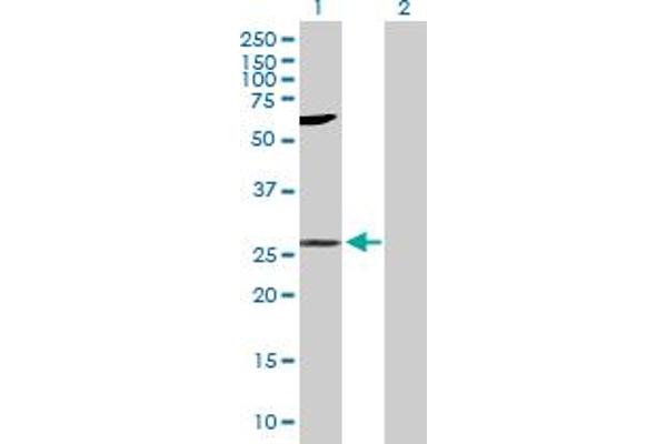 LIN7A anticorps  (AA 1-233)
