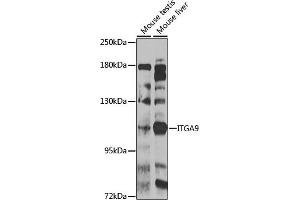 Western blot analysis of extracts of various cell lines, using ITG antibody (ABIN6133048, ABIN6142571, ABIN6142573 and ABIN6223622) at 1:1000 dilution.