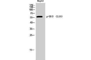 Western Blotting (WB) image for anti-Estrogen Receptor 2 (ESR2) (pSer105) antibody (ABIN3182441)