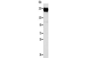 Gel: 6 % SDS-PAGE, Lysate: 40 μg, Lane: K562 cells, Primary antibody: ABIN7130945(RRBP1 Antibody) at dilution 1/400, Secondary antibody: Goat anti rabbit IgG at 1/8000 dilution, Exposure time: 10 seconds (RRBP1 antibody)