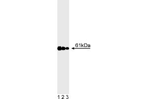 Western Blotting (WB) image for anti-Calcineurin (CAN) (AA 349-505) antibody (ABIN967510) (CAN antibody  (AA 349-505))