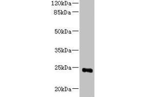 Western blot All lanes: MED18 antibody at 0. (MED18 antibody  (AA 35-208))