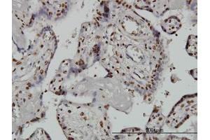 Image no. 3 for anti-AT Rich Interactive Domain 1B (SWI1-Like) (ARID1B) (AA 1364-1461) antibody (ABIN599288) (ARID1B antibody  (AA 1364-1461))
