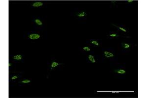 Immunofluorescence of monoclonal antibody to LHX4 on HeLa cell. (LHX4 antibody  (AA 291-390))