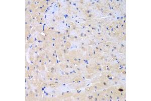 Immunohistochemistry of paraffin-embedded mouse heart using ARHGEF9 antibody at dilution of 1:100 (40x lens). (Arhgef9 antibody)