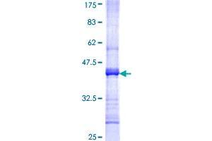 Image no. 1 for Cholinergic Receptor, Nicotinic, alpha 2 (Neuronal) (CHRNA2) (AA 27-136) protein (GST tag) (ABIN1349396) (CHRNA2 Protein (AA 27-136) (GST tag))