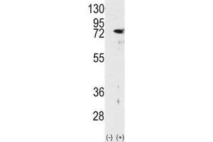 Western blot analysis of PKC delta antibody and 293 cell lysate either nontransfected (Lane 1) or transiently transfected with the PRKCD gene (2). (PKC delta antibody  (AA 298-326))