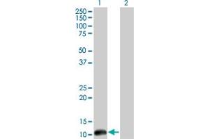 Western Blotting (WB) image for anti-Cleavage Stimulation Factor, 3' Pre-RNA, Subunit 3, 77kDa (CSTF3) (AA 1-104) antibody (ABIN598634) (CSTF3 antibody  (AA 1-104))