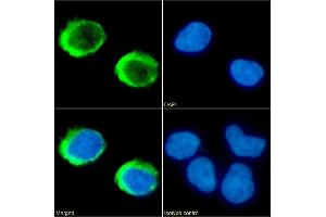 Immunofluorescence staining of fixed Jurkat cells with anti-CD154 antibody IDEC-131 (Toralizumab). (Recombinant sCD40L (Toralizumab Biosimilar) antibody)
