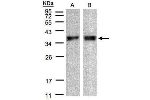 ZPBP antibody