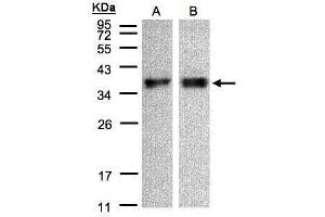 WB Image Sample(30 μg of whole cell lysate) A:A431, B:HeLa S3, 12% SDS PAGE antibody diluted at 1:500 (ZPBP antibody)