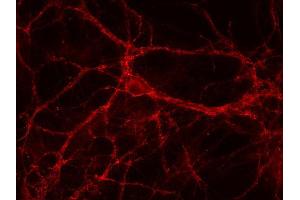 Indirect immunostaining of PFA fixed rat hippocampus neurons (dilution 1 : 500). (SLC6A1 antibody)
