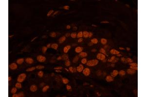Immunofluorescence (IF) image for anti-Matrin 3 (MATR3) (C-Term) antibody (ABIN7448986) (MATR3 antibody  (C-Term))
