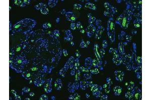 IF analysis of SLC4A1 using anti-SLC4A1 antibody (ABIN3043930) SLC4A1 was detected in paraffin-embedded section of human placenta tissues. (Band 3/AE1 antibody  (AA 28-365))