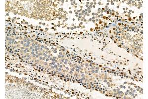 ABIN6261827 and ABIN6278382 at 1/100 staining Rat testis tissue by IHC-P.