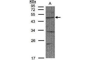 WB Image Sample(30 μg of whole cell lysate) A:A431, 10% SDS PAGE antibody diluted at 1:1500 (FBXW2 antibody  (C-Term))