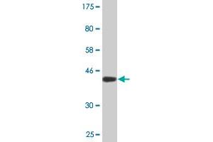 Western Blot detection against Immunogen (40. (BRD3 antibody  (AA 418-556))