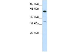 WB Suggested Anti-ZNF609 Antibody Titration: 1. (ZNF609 antibody  (N-Term))