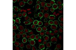 Immunofluorescence (IF) image for anti-Sialophorin (SPN) antibody (ABIN6940632)