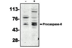 Image no. 1 for anti-Caspase 6, Apoptosis-Related Cysteine Peptidase (CASP6) antibody (ABIN201601) (Caspase 6 antibody)