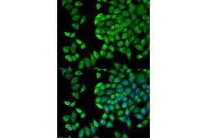 Immunofluorescence analysis of HeLa cells using WNK1 antibody. (WNK1 antibody  (AA 1-210))