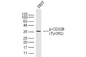 Human 293T cells probed with CD32B(Tyr292) Polyclonal Antibody, unconjugated  at 1:300 overnight at 4°C followed by a conjugated secondary antibody at 1:10000 for 90 minutes at 37°C.