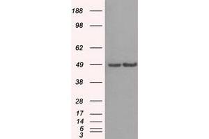 HEK293T cells were transfected with the pCMV6-ENTRY control (Left lane) or pCMV6-ENTRY LEMD3 (Right lane) cDNA for 48 hrs and lysed. (LEMD3 antibody)
