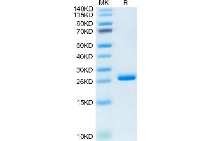Human LILRB2 Domain 1&2 on Tris-Bis PAGE under reduced condition. (LILRB2 Protein (AA 22-229) (His tag))