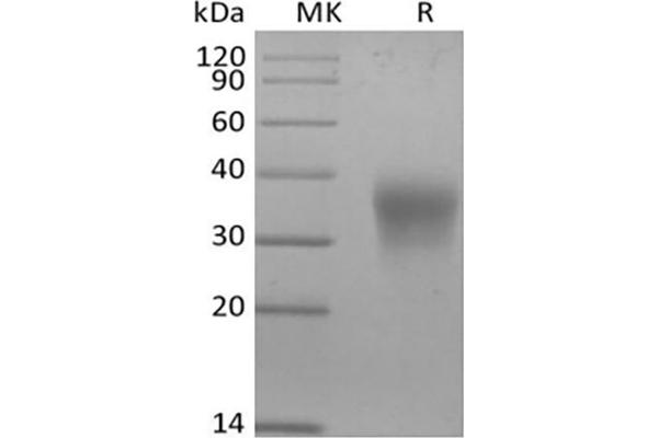 EPO Protein (His tag)