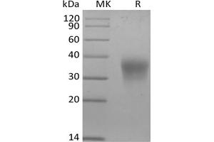 Western Blotting (WB) image for Erythropoietin (EPO) (Active) protein (His tag) (ABIN7320904) (EPO Protein (His tag))