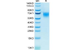 Biotinylated Human CD200 R1 on Tris-Bis PAGE under reduced condition. (CD200R1 Protein (His-Avi Tag,Biotin))