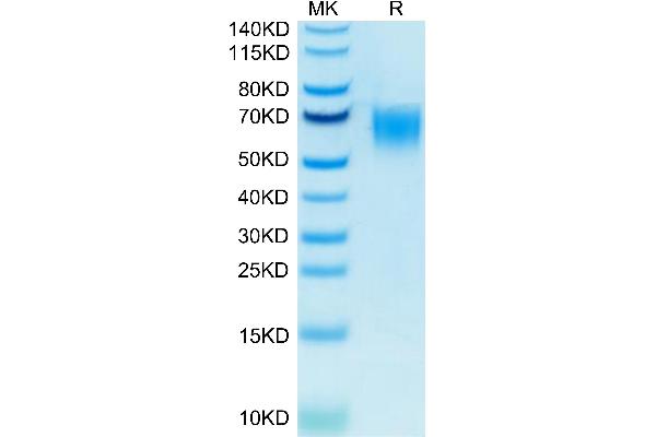 CD200R1 Protein (His-Avi Tag,Biotin)