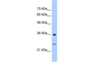 Western Blotting (WB) image for anti-Glutathione Transferase zeta 1 (Maleylacetoacetate Isomerase) (GSTZ1) antibody (ABIN2463253) (GSTZ1 antibody)