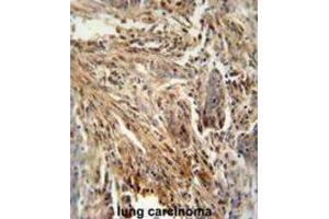 Immunohistochemistry (IHC) image for anti-Colony Stimulating Factor 2 (Granulocyte-Macrophage) (CSF2) antibody (ABIN2995782)