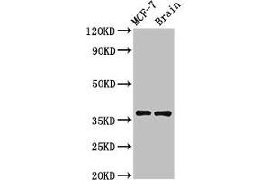 Western Blot Positive WB detected in: MCF-7 whole cell lysate, Rat brain tissue All lanes: MENT antibody at 3.