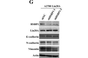 Lin28A promoted the proliferation and invasion of OC cells by up-regulating HSBP1.