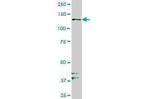 PTK7 monoclonal antibody (M03), clone 4A6 Western Blot analysis of PTK7 expression in MCF-7 . (PTK7 antibody  (AA 36-145))