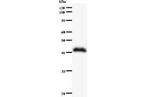 Western Blotting (WB) image for anti-SWI/SNF Related, Matrix Associated, Actin Dependent Regulator of Chromatin, Subfamily A, Member 4 (SMARCA4) antibody (ABIN930944) (SMARCA4 antibody)