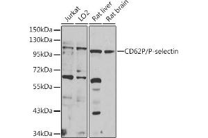 Western blot analysis of extracts of various cell lines, using CD62P/P-selectin antibody (ABIN6131514, ABIN6147503, ABIN6147506 and ABIN6218519) at 1:1000 dilution.
