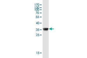 SCGB2A1 antibody  (AA 1-95)