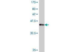 Western Blot detection against Immunogen (38. (SMC5 antibody  (AA 992-1101))