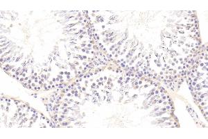 Detection of AXL in Rat Testis Tissue using Polyclonal Antibody to AXL Receptor Tyrosine Kinase (AXL) (AXL antibody  (AA 21-202))