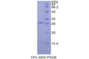 SDS-PAGE (SDS) image for Glutathione S-Transferase pi 1 (GSTP1) (AA 1-210) protein (His tag) (ABIN1079724) (GSTP1 Protein (AA 1-210) (His tag))