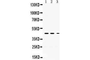 Western Blotting (WB) image for anti-serpin Peptidase Inhibitor, Clade I (neuroserpin), Member 1 (SERPINI1) (AA 272-310), (C-Term) antibody (ABIN3043332) (Neuroserpin antibody  (C-Term))