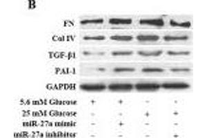 Western Blotting (WB) image for anti-Fibronectin (AA 1201-1300) antibody (ABIN671646)