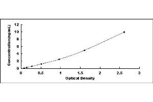 Typical standard curve (CPT1A ELISA Kit)