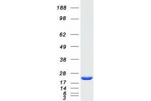 Western Blotting (WB) image for Ferritin, Light Polypeptide (FTL) protein (Myc-DYKDDDDK Tag) (ABIN2721021)