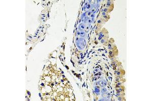 Immunohistochemistry of paraffin-embedded mouse lung using SDC2 antibody (ABIN3022587, ABIN3022588, ABIN3022589 and ABIN6218928) at dilution of 1:100 (40x lens). (Syndecan 2 antibody  (AA 19-144))