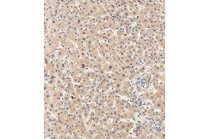 Immunohistochemistry (Paraffin-embedded Sections) (IHC (p)) image for anti-Ubiquitin Specific Peptidase 15 (USP15) (AA 151-180), (N-Term) antibody (ABIN388904)